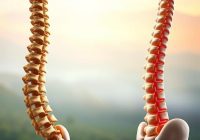 Rehabilitacja skolioz: metody, diagnoza i wpływ na jakość życia