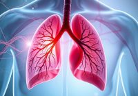 Zatorowość płucna – objawy, diagnoza i profilaktyka choroby