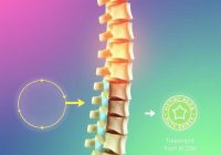 Dyskopatia: przyczyny, objawy i skuteczne metody leczenia